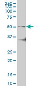 IRAK4 Monoclonal Antibody (2D3)