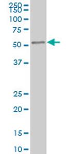 IRAK4 Monoclonal Antibody (1D4)