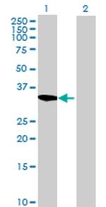 C1ORF33 Antibody in Western Blot (WB)