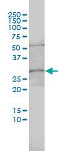 C1orf33 Antibody in Western Blot (WB)