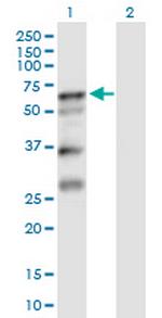 SERPINA10 Antibody in Western Blot (WB)
