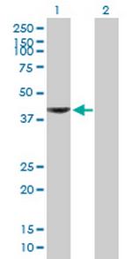 AADAT Polyclonal Antibody, MaxPab™