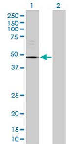 TUBE1 Polyclonal Antibody, MaxPab™