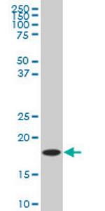 LEF1 Antibody in Western Blot (WB)