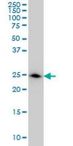 DCXR Monoclonal Antibody (6A6)