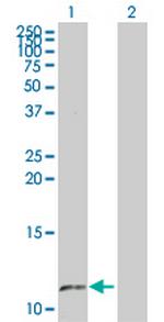 SS18L2 Polyclonal Antibody, MaxPab™