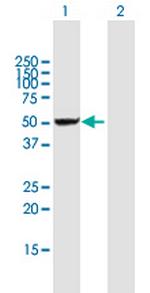 DDX47 Polyclonal Antibody, MaxPab™