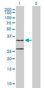 CCDC44 Polyclonal Antibody, MaxPab™