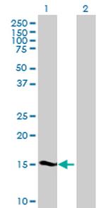 SHISA5 Polyclonal Antibody, MaxPab™