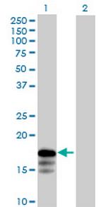 RNF181 Antibody in Western Blot (WB)