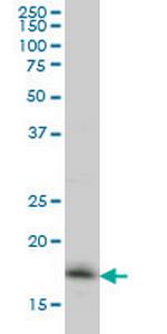 RNF181 Monoclonal Antibody (5A7)