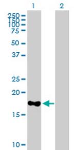 MARCH2 Polyclonal Antibody, MaxPab™