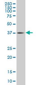 TFDP3 Antibody in Western Blot (WB)