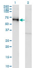 GOLM1 Monoclonal Antibody (5B10)