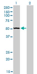 BFAR Antibody in Western Blot (WB)