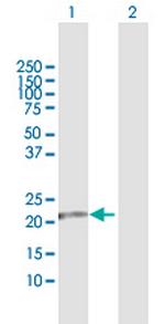 FKBP11 Antibody in Western Blot (WB)