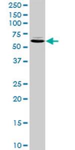 TXNDC3 Antibody in Western Blot (WB)