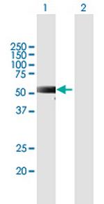 RKHD2 Polyclonal Antibody, MaxPab™