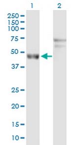 ARL6IP4 Antibody in Western Blot (WB)