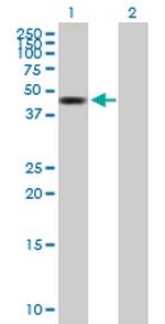 ZMYND10 Antibody in Western Blot (WB)