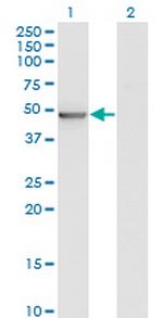 ZMYND10 Antibody in Western Blot (WB)