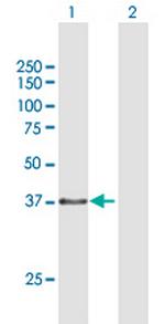 TEX264 Antibody in Western Blot (WB)