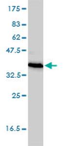 TEX264 Antibody in Western Blot (WB)