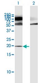 POMP Polyclonal Antibody, MaxPab™