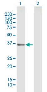 UCHL5 Polyclonal Antibody, MaxPab™
