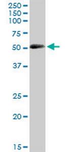 CRLF3 Polyclonal Antibody, MaxPab™