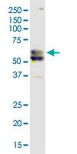 CSAD Monoclonal Antibody (2C11)