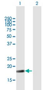 NIP7 Polyclonal Antibody, MaxPab™