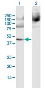 PPME1 Polyclonal Antibody, MaxPab™