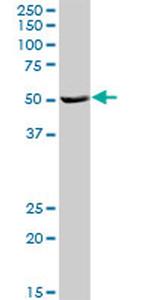 HSFX1 Antibody in Western Blot (WB)