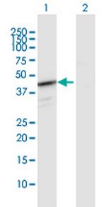 HEMK1 Polyclonal Antibody, MaxPab™