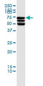 DDX41 Monoclonal Antibody (2F4)