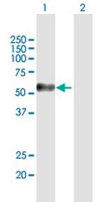 MAGEC2 Polyclonal Antibody, MaxPab™