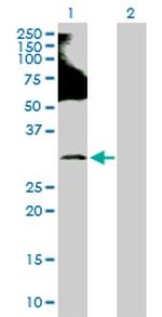 RNF138 Polyclonal Antibody, MaxPab™