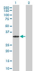 PRRX2 Antibody in Western Blot (WB)