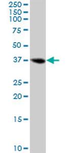 LCMT1 Antibody in Western Blot (WB)
