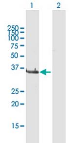 LCMT1 Antibody in Western Blot (WB)