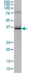 UBE2J1 Monoclonal Antibody (6A12)
