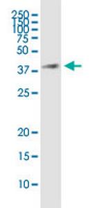 HSD17B7 Monoclonal Antibody (1G10)