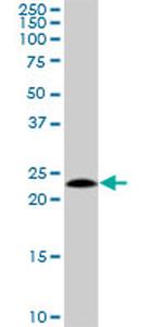 HSPC111 Antibody in Western Blot (WB)