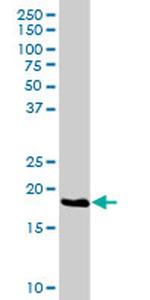 HSPC111 Antibody in Western Blot (WB)