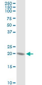 HSPC111 Antibody in Western Blot (WB)