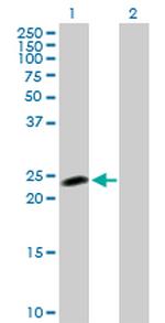 HSPC111 Antibody in Western Blot (WB)