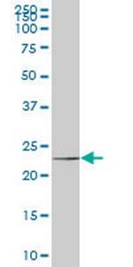 HSPC111 Antibody in Western Blot (WB)