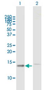 HSPC152 Polyclonal Antibody, MaxPab™