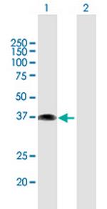 ETV7 Polyclonal Antibody, MaxPab™